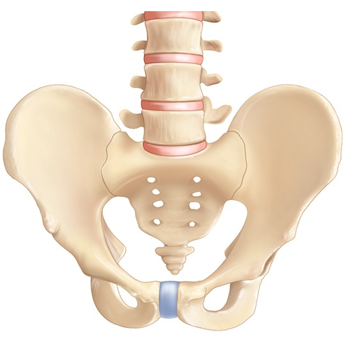 Bilateral Sacroiliitis